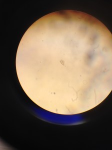 Även i mikroskop är spermierna små. I mitten syns en påse (anteridium) med spermier som just håler på att öppna sig.