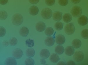 Även om det bitvis var många ägg, så var inga befruktade i det här provet. 