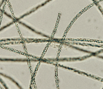 Planktotrix agardhii